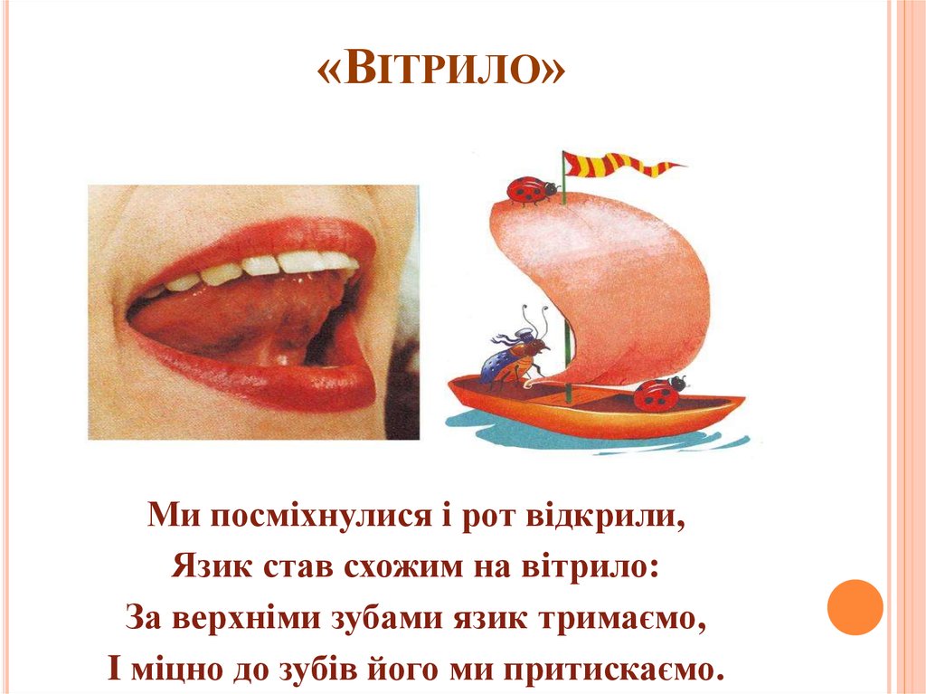 «Вiтрило»