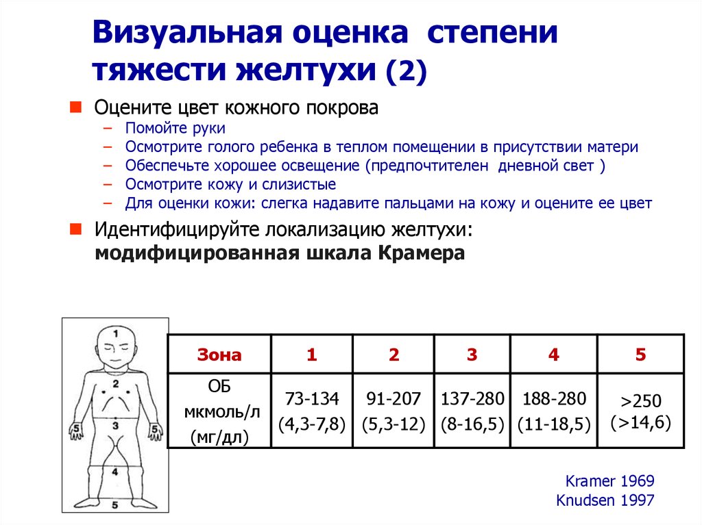 Билирубин при желтухе у новорожденных