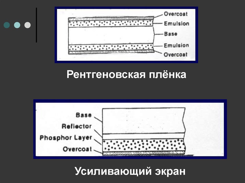 Изображение получаемое на рентгеновской пленке тест