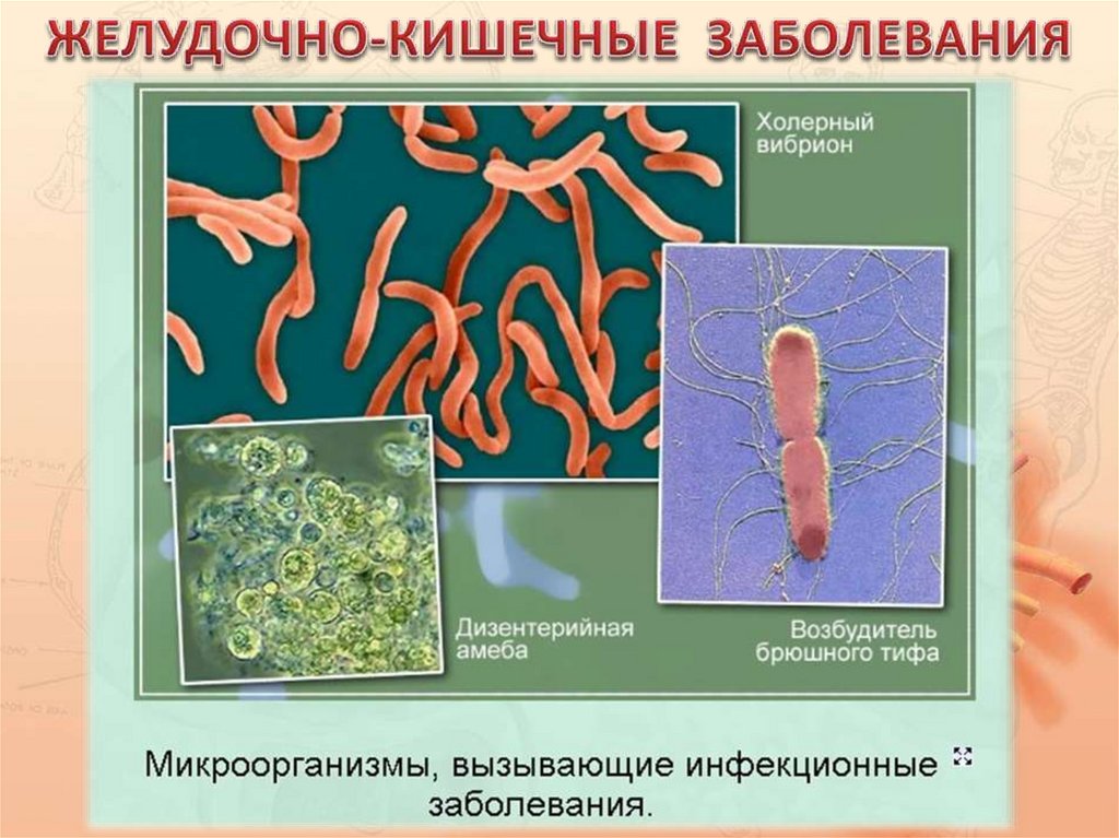 Заболевания пищеварительной системы презентация