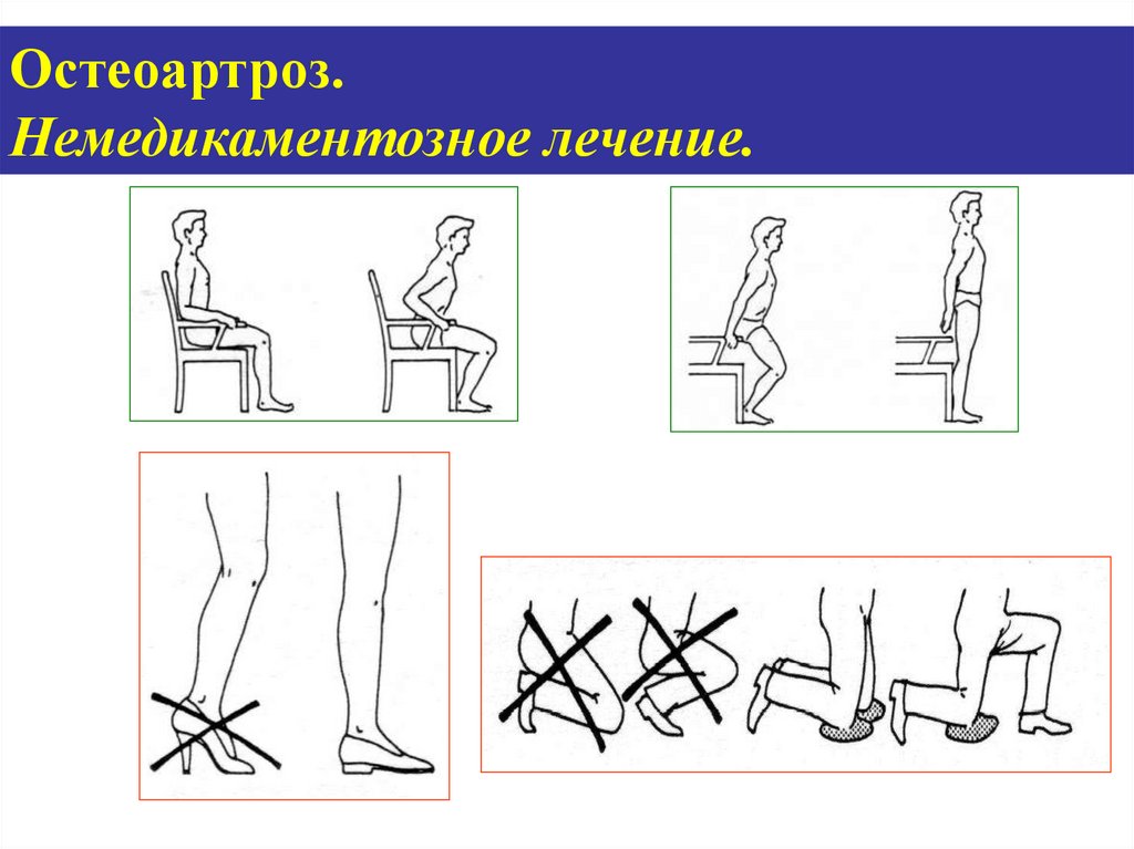 Остеоартроз лечение. Немедикаментозное лечение остеоартроза. Остеоартроз немедикаментозная терапия. Немедикаментозное лечение полиостеоартроз. Немедикаментозные методы лечения остеоартрита.