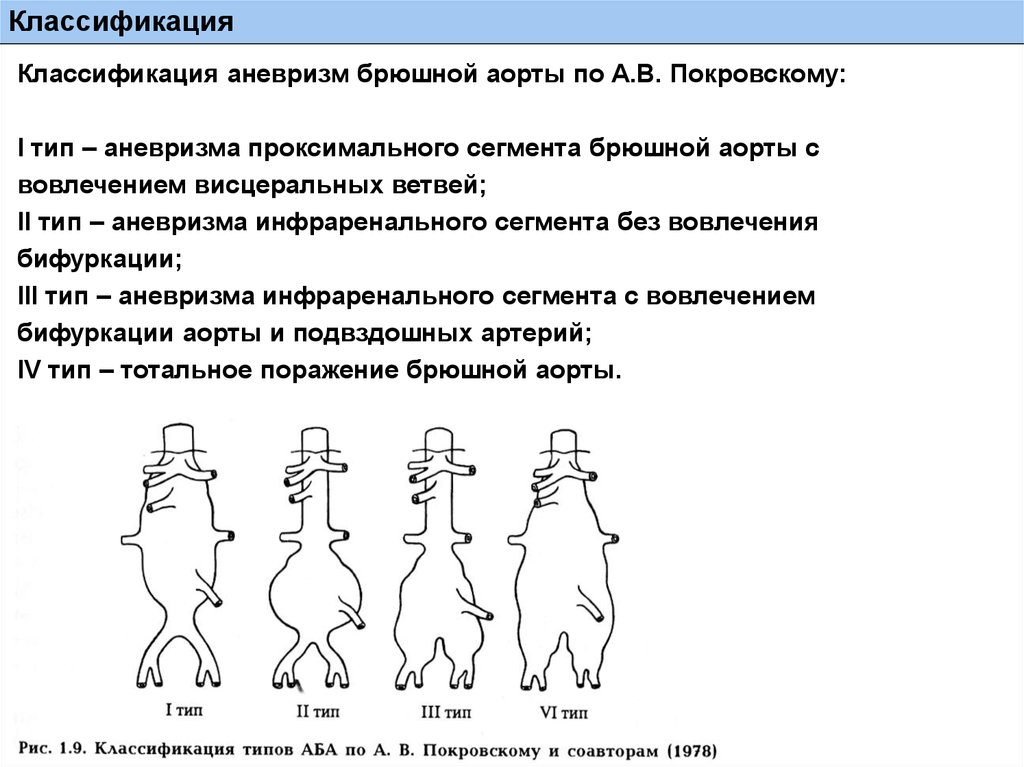 Аневризма брюшной аорты презентация