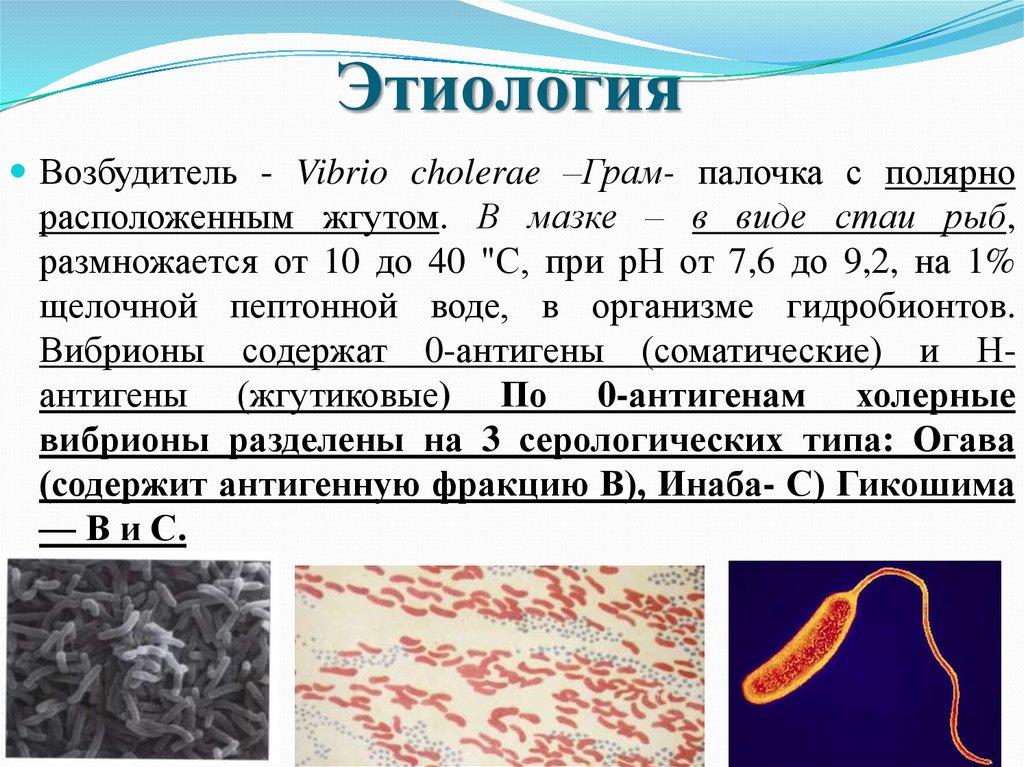 Какой возбудитель холеры. Vibrio cholerae морфология. Вибрио холера морфология. Холерный вибрион микробиология.