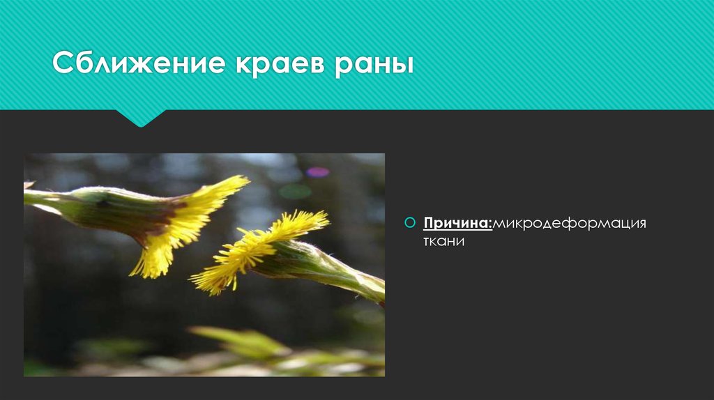 Сближение краев раны