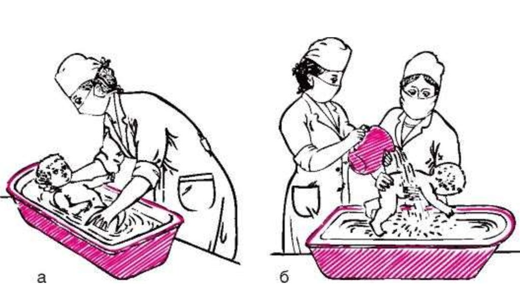 Ванна ребенка алгоритм. Подмывание новорожденного алгоритм. Техника проведения гигиенической ванны новорожденному ребенку. Подмывание новорожденного и грудного ребенка алгоритм. Подмывание детей раннего возраста алгоритм.