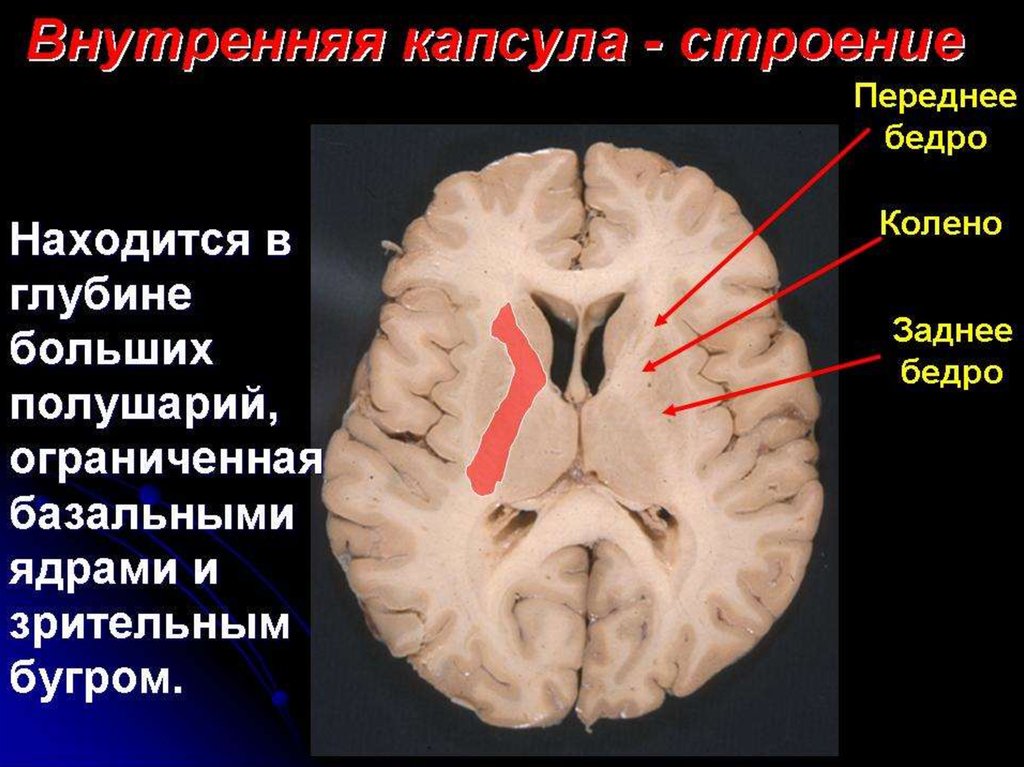 Внутренняя капсула пути волокон схема