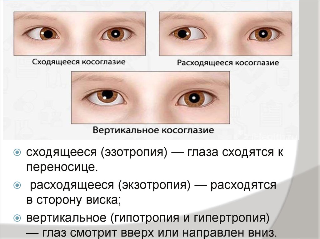 Какой глаз левый а какой правый