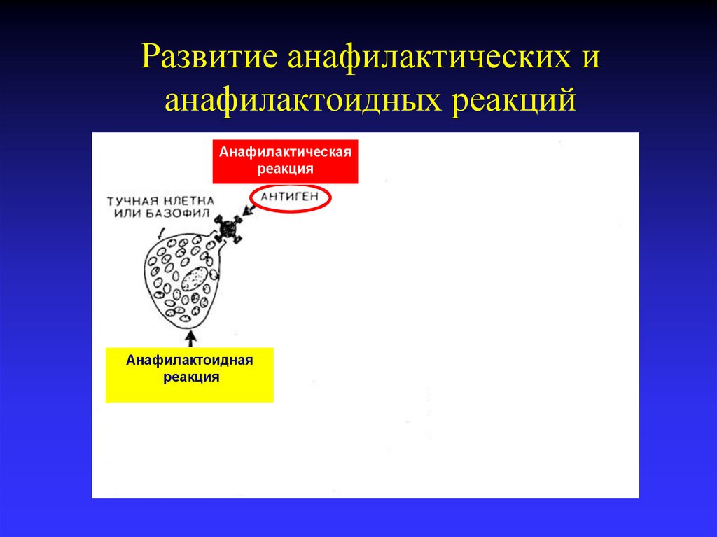 Развитие анафилактических реакций. Анафилактоидная реакция. Анафилактическая реакция. Анафилактическая и анафилактоидная реакция. Анафилактические и анафилактоидные реакции отличия.