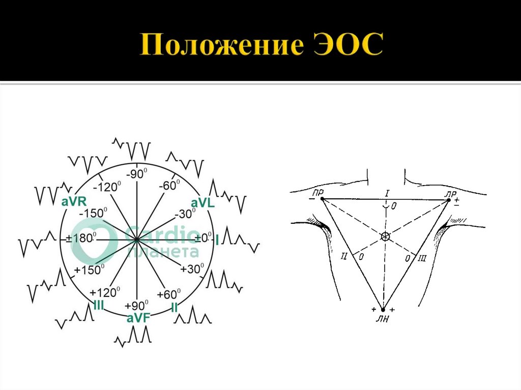 Электрическая ось. ЭОС. 1э. Электронная оже-спектроскопия (ЭОС).. ЭОС по ЭКГ алгоритм.