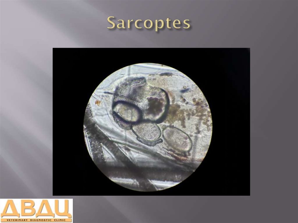 Sarcoptes