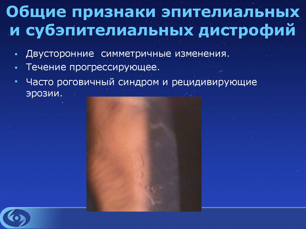 Общие признаки эпителиальных и субэпителиальных дистрофий