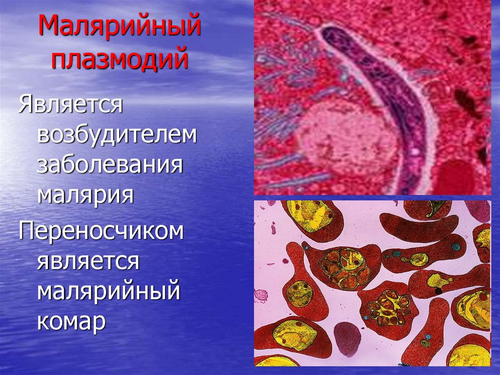 Возбудители болезней простейших. Малярийный плазмодий. Малярийный плазмододий. Малярийный плазмодий это одноклеточный паразит. Паразитические простейшие малярийный плазмодий.
