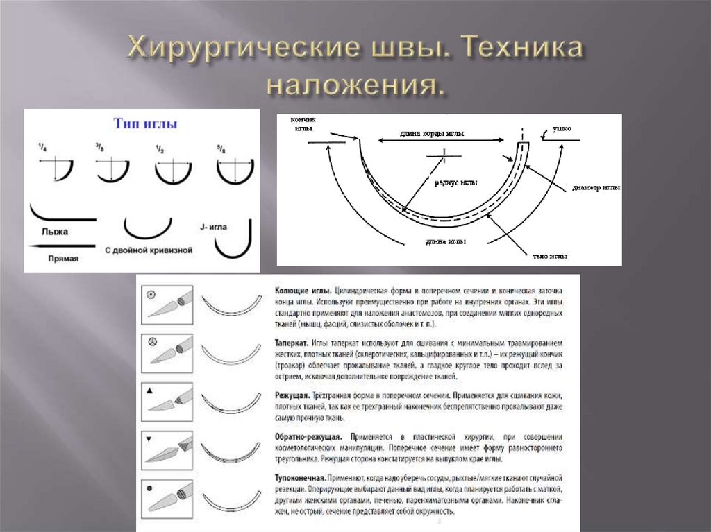 Хирургические швы. Хирургические швы техника. Техника наложения хирургического шва.