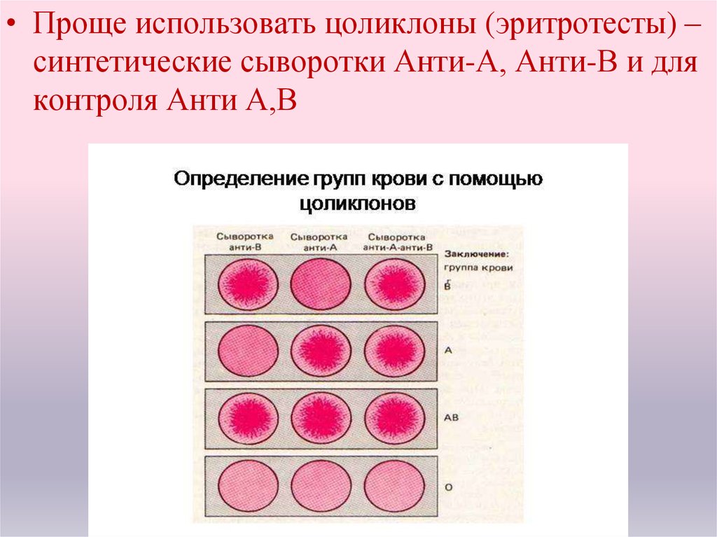 Определить группу крови тест. Цоликлоны для определения группы и резус фактора. Цоликлоны для определения группы крови таблица. Алгоритм определения резус фактора крови по цоликлонам. Группа крови 0 Цоликлоны.