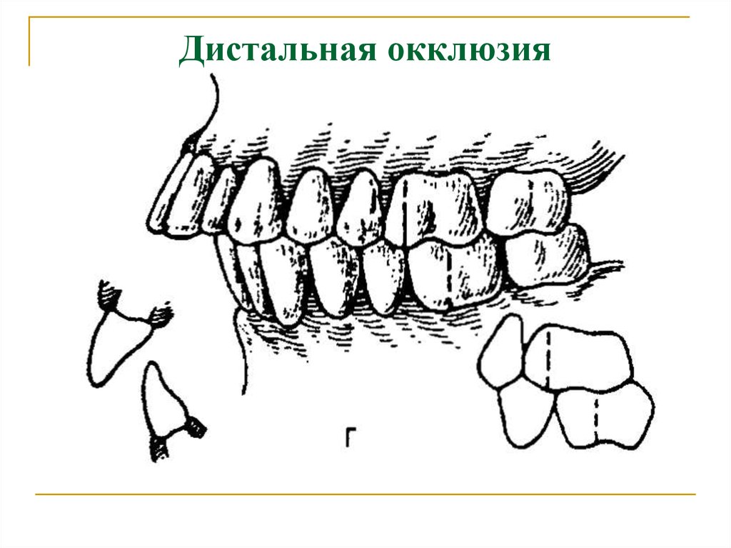 Центральная окклюзия и центральное соотношение челюстей презентация