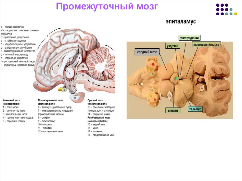 Нервы промежуточного мозга. Препарат промежуточный мозг эпиталамус. Промежуточный мозг таламус гипоталамус эпиталамус. Нервные центры промежуточного мозга. Промежуточный мозг дифференцируется на.
