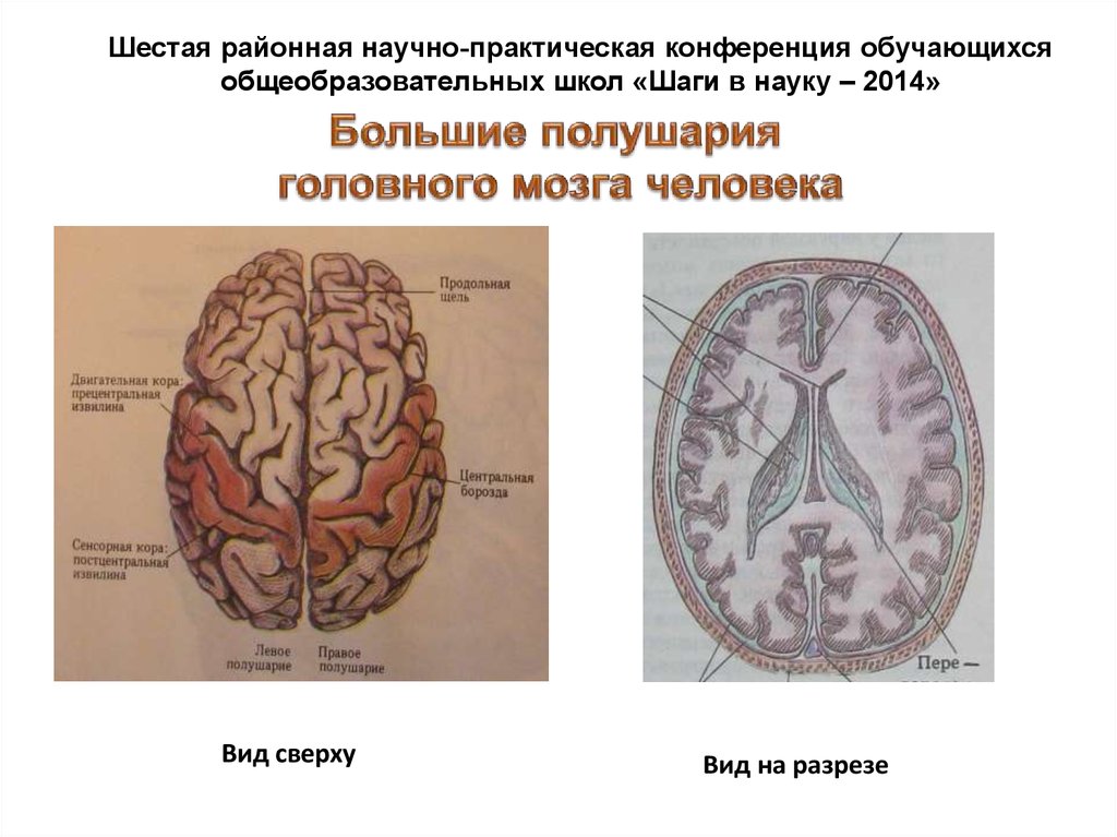 Межполушарная щель