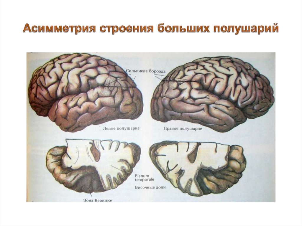 Функциональная асимметрия мозга картинки