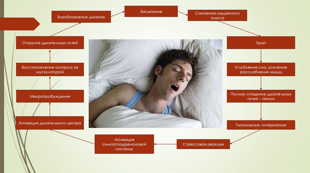 Плохой сон у взрослого причины лечение. Синдром обструктивного апноэ гипопноэ сна. Храп во сне.