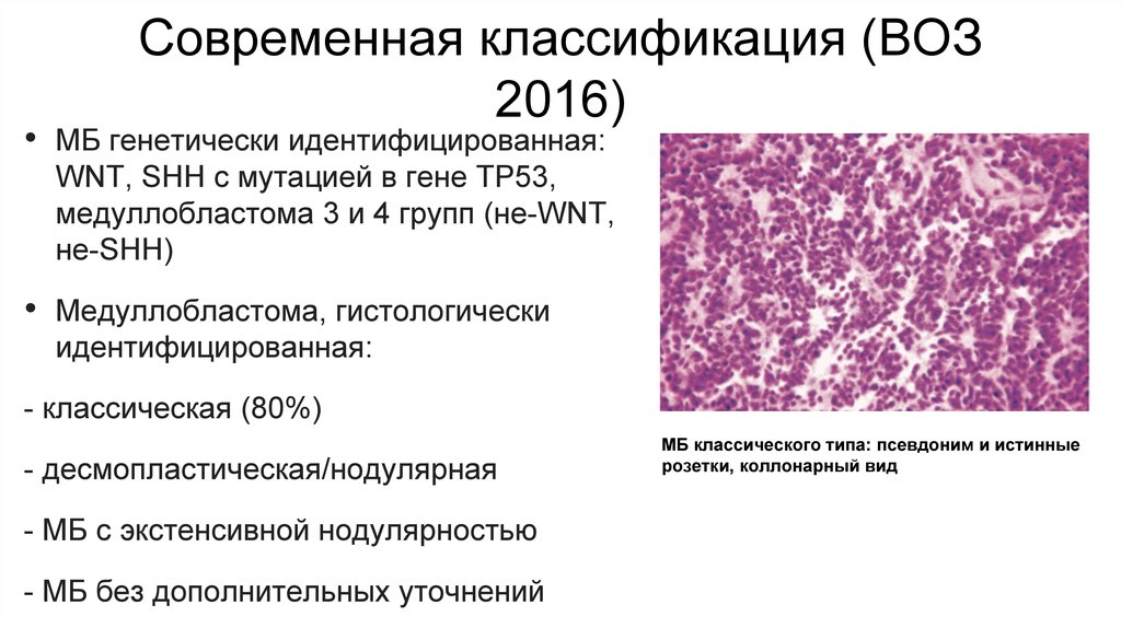 Медуллобластома - презентация онлайн