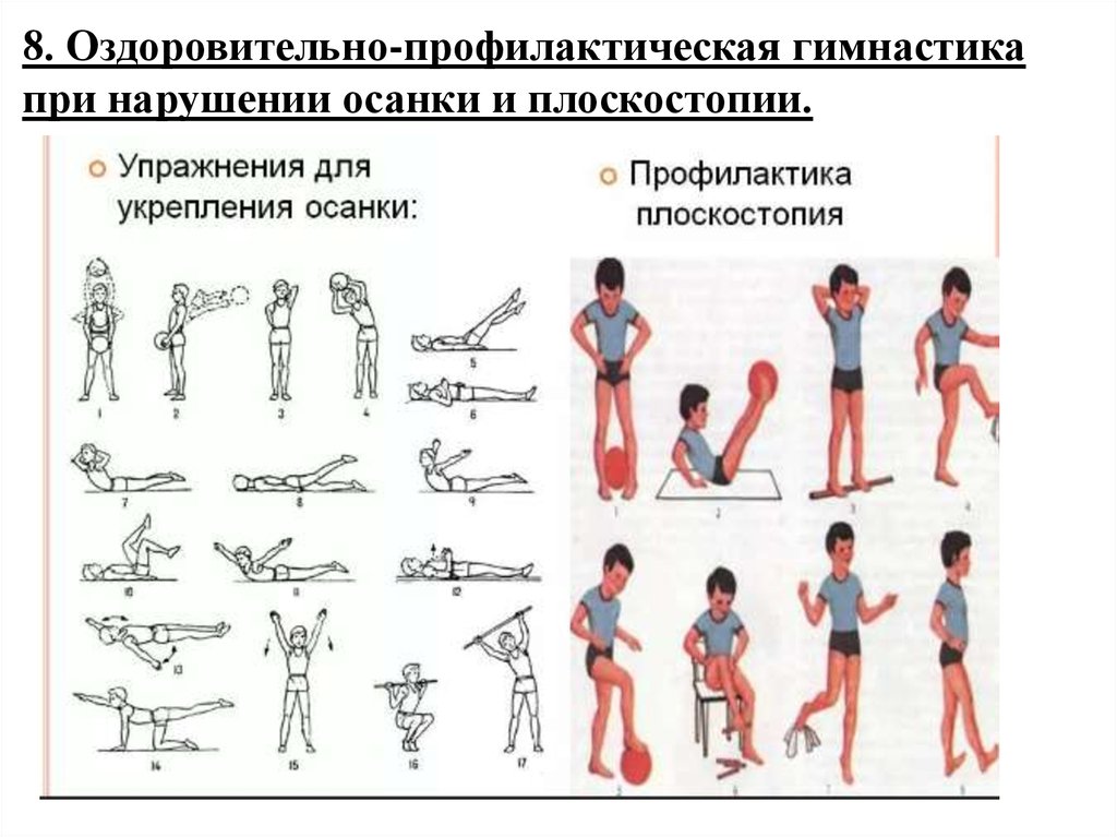 Укрепление ода. Памятка профилактика нарушений опорно двигательной системы. Комплекс упражнений для опорно двигательного аппарата. Физические упражнения при заболевании опорно двигательного аппарата. Предупреждение нарушений осанки.