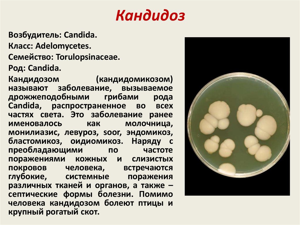 Молочница гриб. Грибы кандида микробиология. Дрожжеподобные грибки рода Candida. Кандида микробиология семейство. Дрожжеподобные грибы возбудители кандидамикозов микробиология.