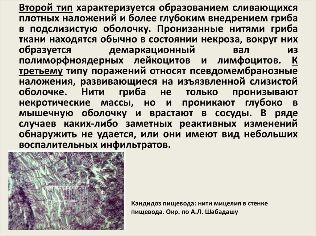 Кандидоза признаки лечение. Кандидоз пищевода клинические рекомендации. Схема терапии кандидоза пищевода. Кандидоз пищевода классификация.