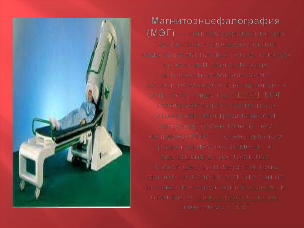 Магнитоэнцефалография (МЭГ) — нейровизуализационная технология, используемая для измерения магнитных полей, которую производит