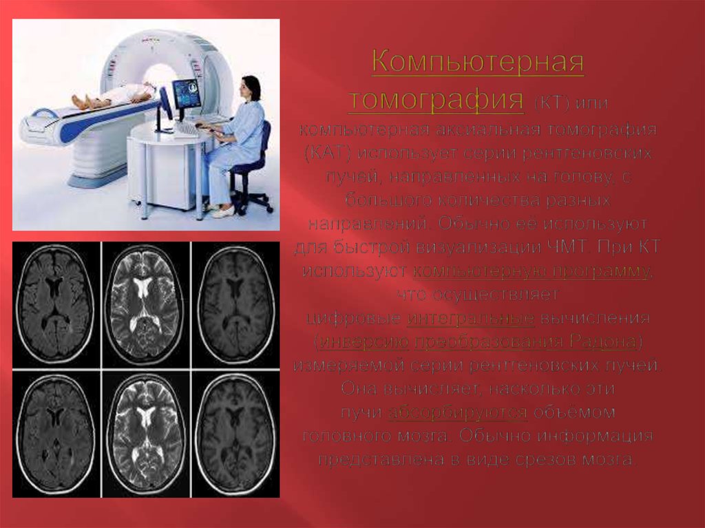 Компьютерная томография (КТ) или компьютерная аксиальная томография (КАТ) использует серии рентгеновских лучей, направленных на