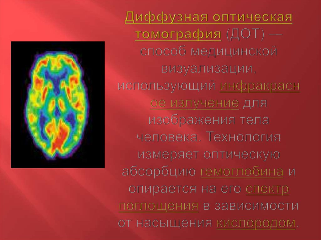 Диффузная оптическая томография (ДОТ) — способ медицинской визуализации, использующий инфракрасное излучение для изображения