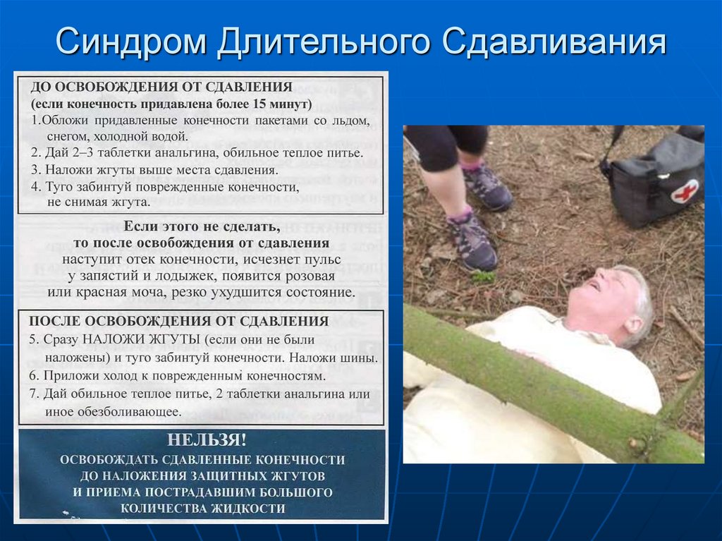 Синдром Длительного Сдавливания