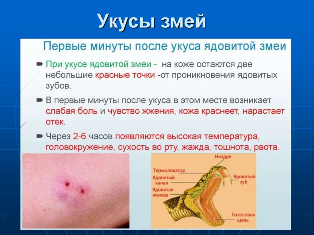 Укусы змей