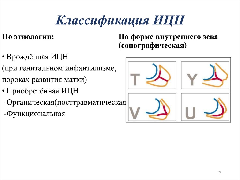 Истмико цервикальная недостаточность презентация