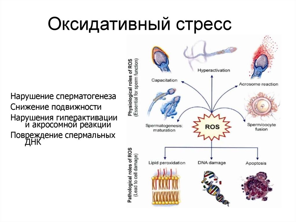 Окислительный стресс презентация