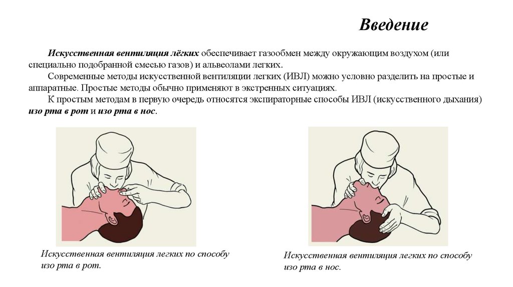 Проведение искусственной вентиляции легких. Частота дыхательных циклов при искусственной вентиляции легких (ИВЛ). Частота раздувания легких при ИВЛ. Частота дыхательных циклов при искусственной вентиляции легких. При проведении ИВЛ методом рот в рот необходимо.