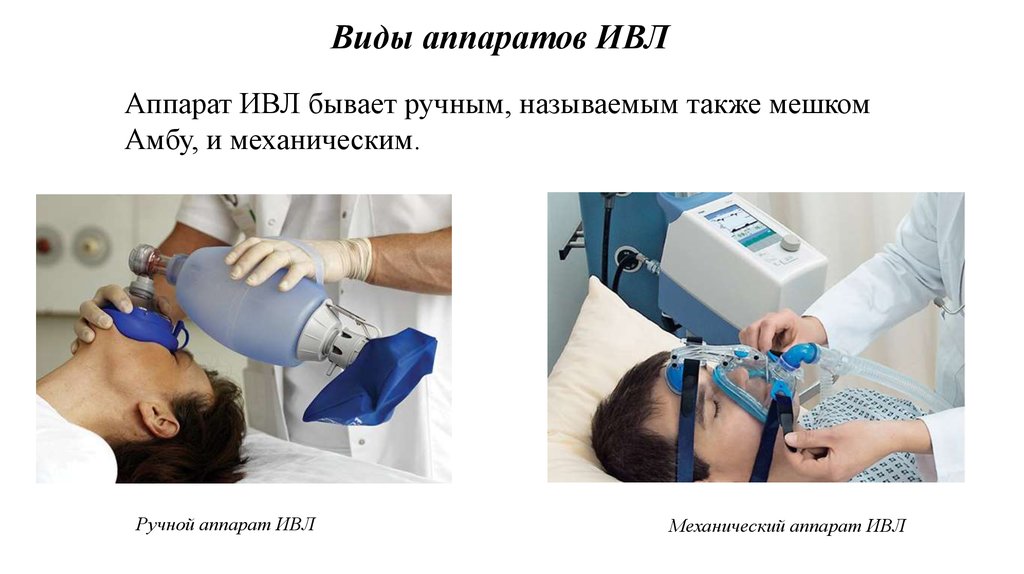 Последствия после ивл. Аппарат искусственной вентиляции лёгких. Виды искусственной вентиляции легких. Типы аппаратов ИВЛ.