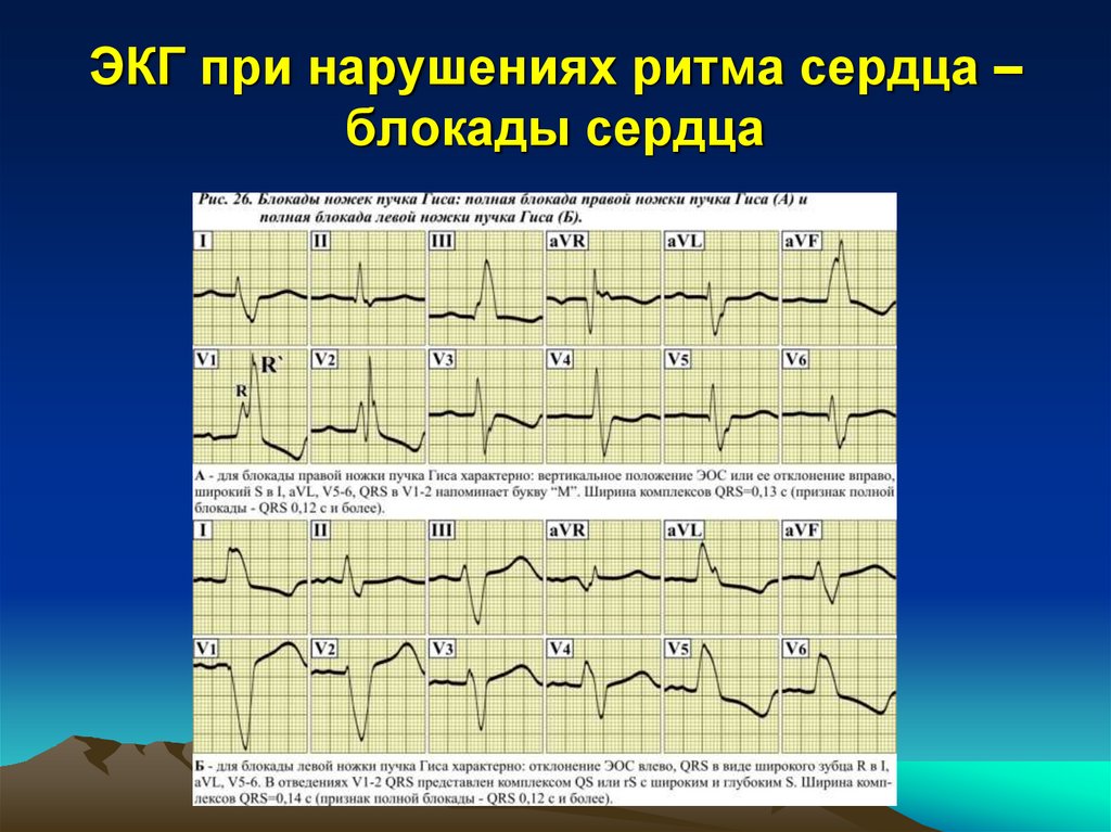 Выпадение комплекса