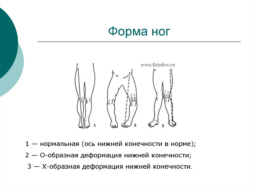 Нормальная ось