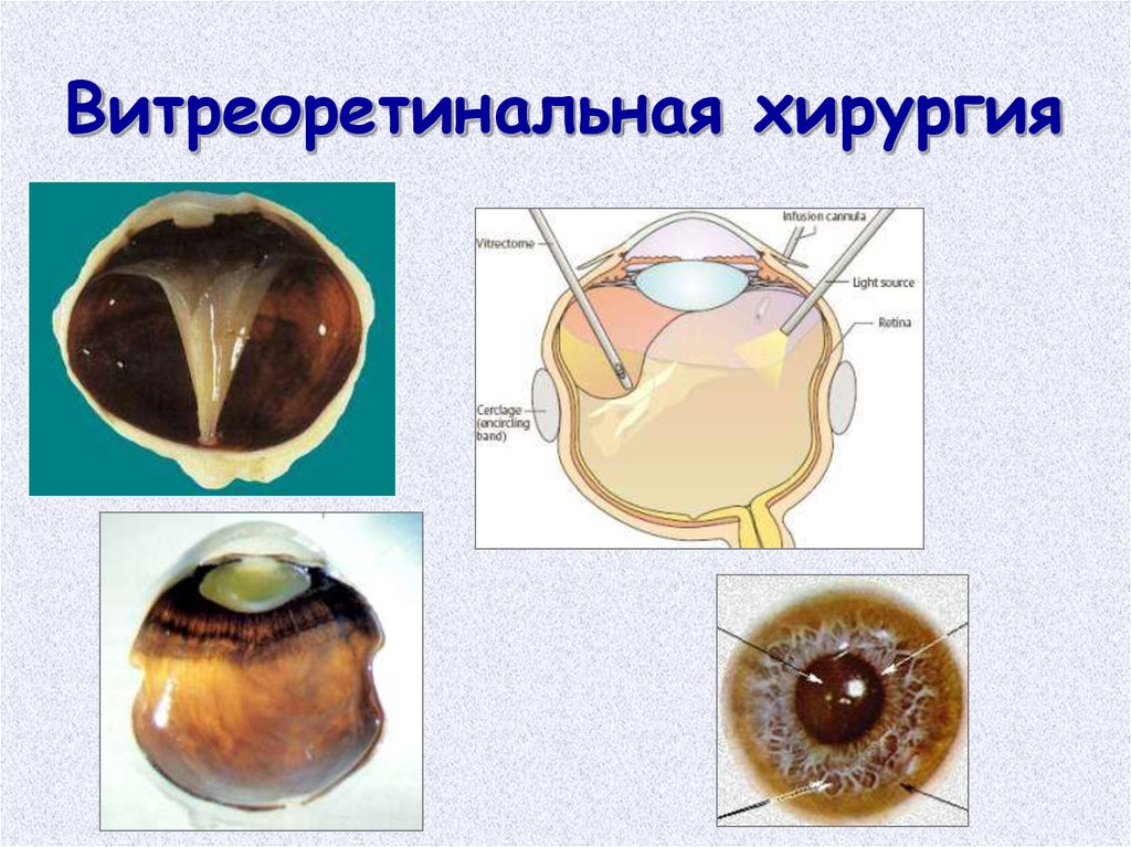 Презентация история офтальмологии