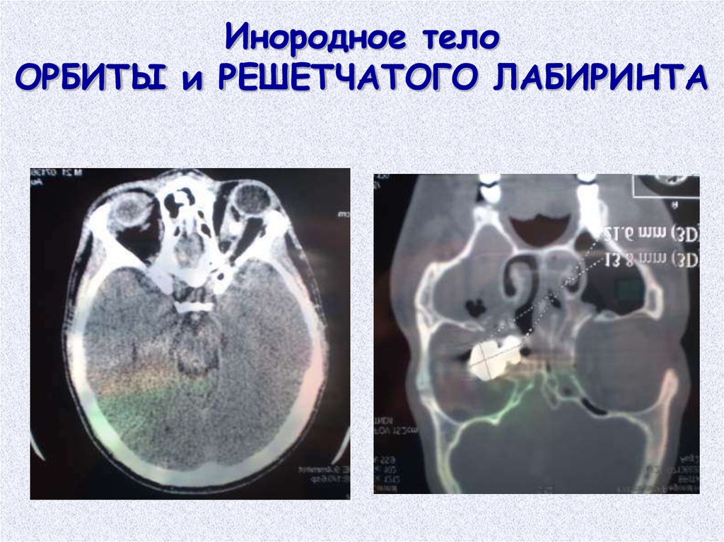 Презентация история офтальмологии