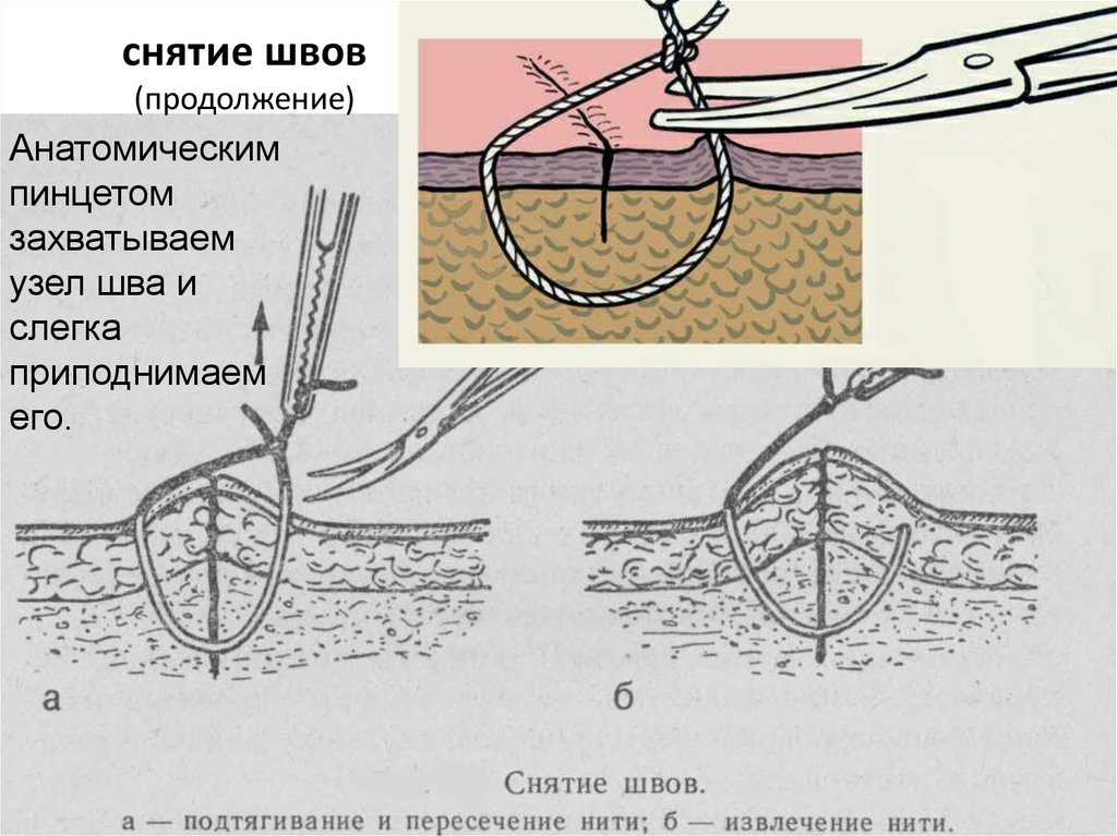 После удаления какого времени можно