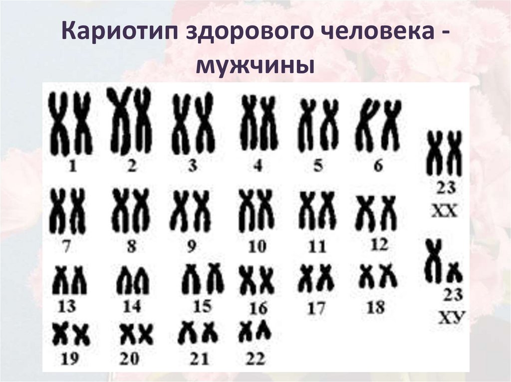 Определенное количество хромосом. Кариограмма хромосом мужчины. Кариотип человека. Нормальный кариотип. Здоровый кариотип.