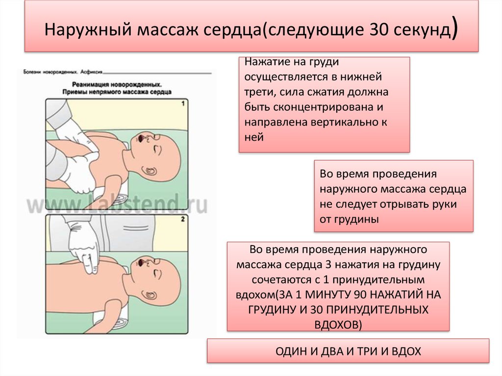 Вкладыш карта реанимации и стабилизации состояния новорожденных детей в родильном зале