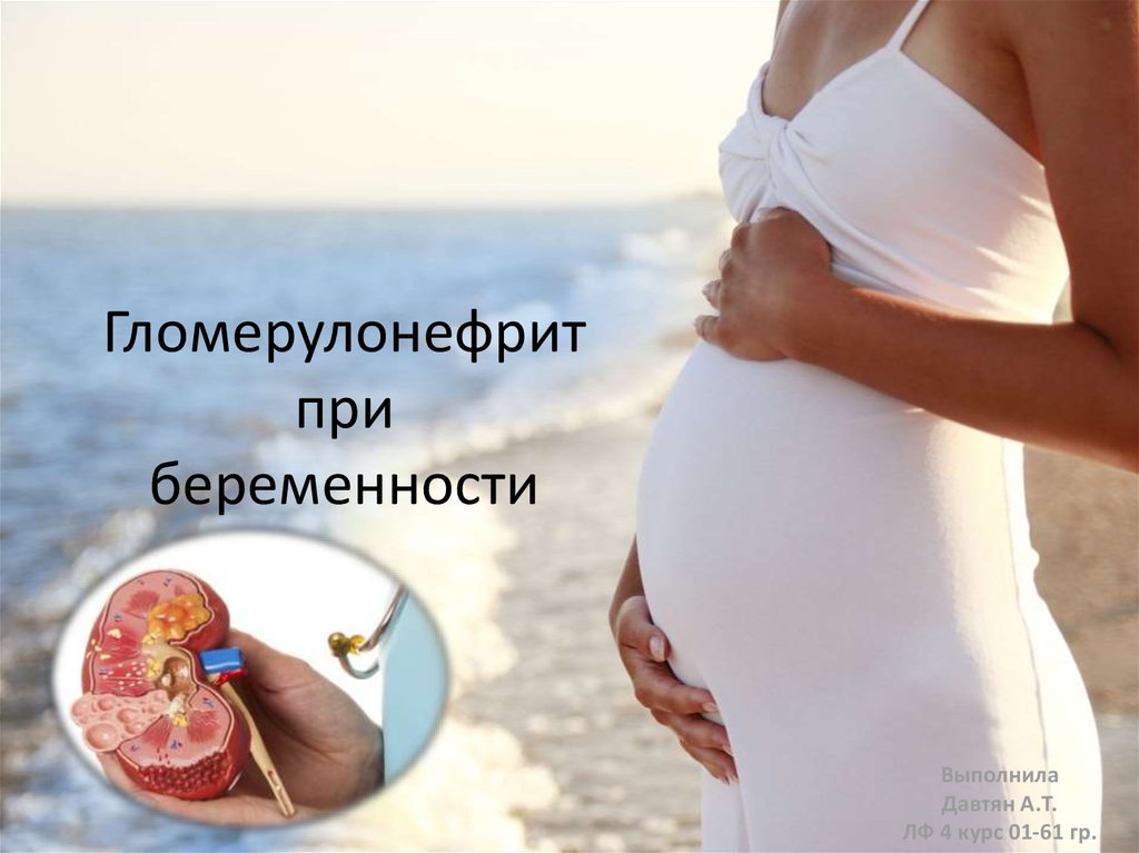 Беременность хроническое заболевание. Гломерулонефрит у беременной. Гломерулонефрит и беременность. Острый гломерулонефрит и беременность.