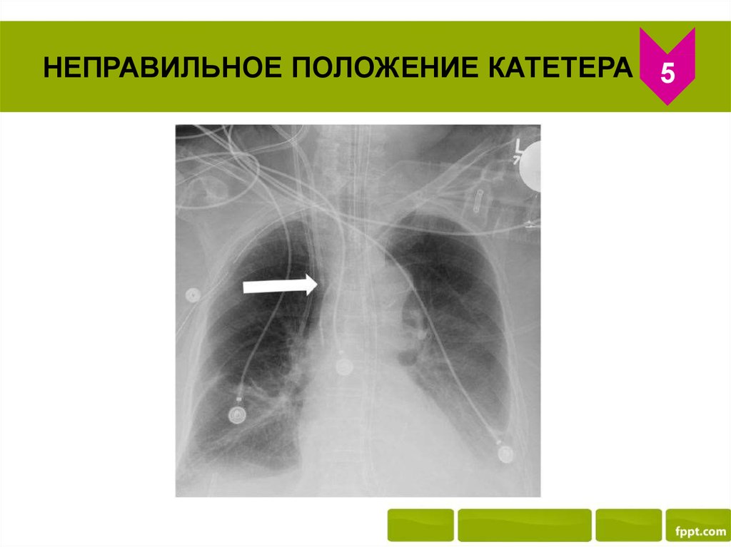 Венозный доступ презентация