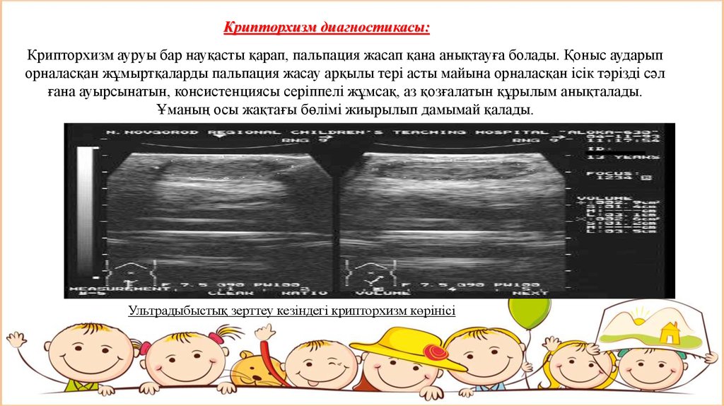 Ложный крипторхизм у детей. Как проходит операция при крипторхизме у ребенка в год.