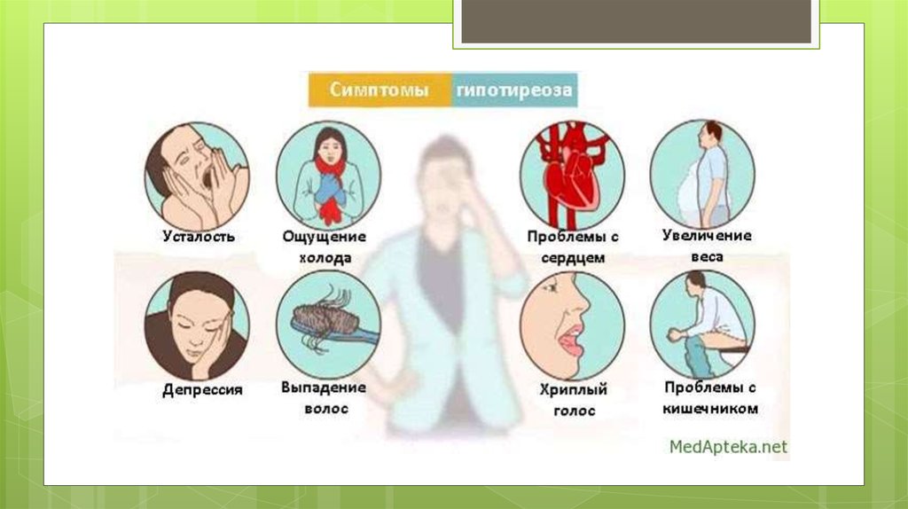 Гипотиреоз причины симптомы. Гипотиреоз щитовидной железы симптомы. Щитовидная железа симптомы заболевания гипотиреоз. Сниженная функция щитовидной железы симптомы. Болезнь щитовидной железы гипотиреоз.