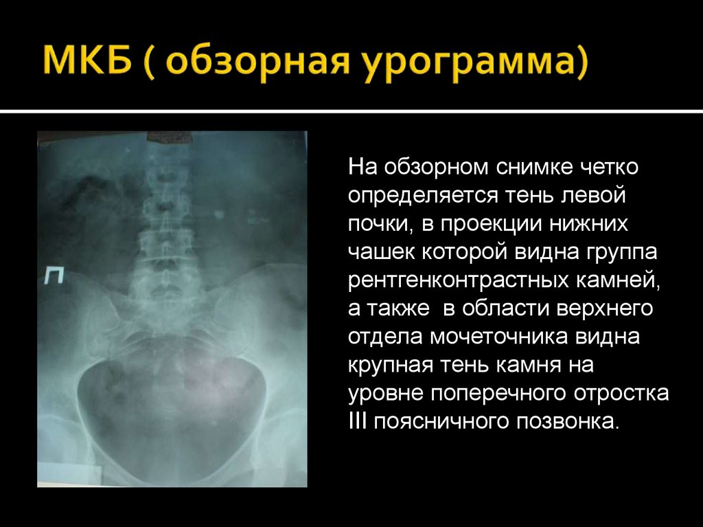 Лучевая диагностика почек презентация