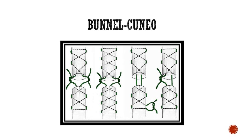 Bunnel-cuneo