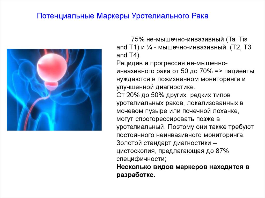 Презентации по урологии